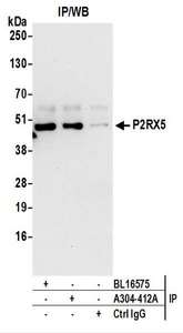 Detection of Human P2RX5 by Western Blot of Immunoprecipitates. Samples: Whole cell lysate (1 mg for IP; 20% of IP loaded) prepared using NETN buffer from HeLa cells. Antibodies: Affinity purified rabbit anti-P2RX5 antibody used for IP at 6 ug per reaction. P2RX5 was also immunoprecipitated by rabbit anti-P2RX5 antibody BL16575. For blotting immunoprecipitated P2RX5, was used at 0.1 ug/ml. Detection: Chemiluminescence with an exposure time of 30 seconds.