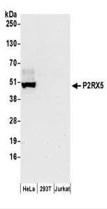 Detection of Human P2RX5 by Western Blot. Samples: Whole cell lysate (50 ug) prepared using NETN buffer from HeLa, 293T, and Jurkat cells. Antibodies: Affinity purified rabbit anti-P2RX5 antibody used for WB at 0.1 ug/ml. Detection: Chemiluminescence with an exposure time of 30 seconds.