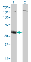 Western Blot analysis of P2RX5 expression in transfected 293T cell line by P2RX5 monoclonal antibody (M01), clone 1C5.Lane 1: P2RX5 transfected lysate(46.42 KDa).Lane 2: Non-transfected lysate.