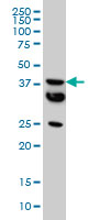 MT monoclonal antibody (M01), clone 2F2 Western blot of MT expression in HeLa.
