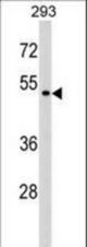 P2RX6 Antibody western blot of 293 cell line lysates (35 ug/lane). The P2RX6 antibody detected the P2RX6 protein (arrow).