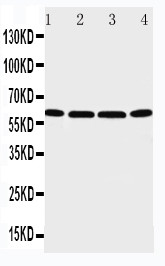 WB of P2RX6 / P2X6 antibody. Lane 1: U87 Cell Lysate. Lane 2: 22RV1 Cell Lysate. Lane 3: JURKAT Cell Lysate. Lane 4: HT1080 Cell Lysate.
