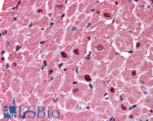 Anti-P2RX6 / P2X6 antibody IHC of human heart. Immunohistochemistry of formalin-fixed, paraffin-embedded tissue after heat-induced antigen retrieval. Antibody LS-B154 concentration 1.25 ug/ml.