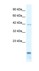 P2RX6 / P2X6 antibody LS-B154 Western blot of HepG2 cell lysate.