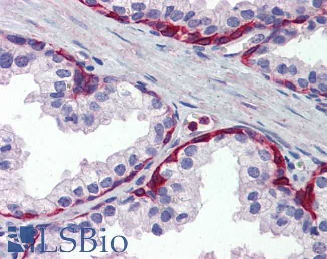 Anti-METTL7A antibody IHC of human prostate. Immunohistochemistry of formalin-fixed, paraffin-embedded tissue after heat-induced antigen retrieval. Antibody LS-B3857 concentration 5 ug/ml.