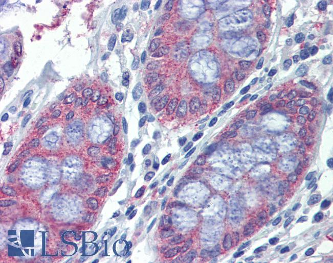 Anti-METTL7B antibody IHC of human colon. Immunohistochemistry of formalin-fixed, paraffin-embedded tissue after heat-induced antigen retrieval. Antibody LS-B3855 concentration 10 ug/ml.