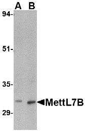 Western blot of MettL7B in rat spleen tissue lysate with MettL7B antibody at (A) 2 and (B) 4 ug/ml.