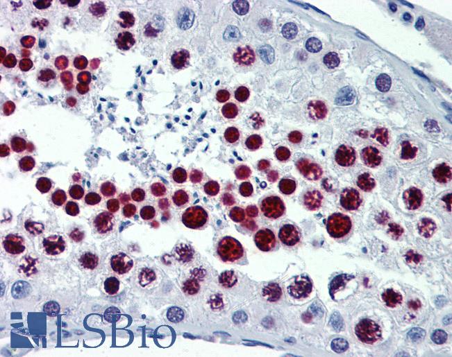 Anti-METTL7B antibody IHC of human testis. Immunohistochemistry of formalin-fixed, paraffin-embedded tissue after heat-induced antigen retrieval. Antibody LS-B3858 concentration 5 ug/ml.