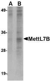 Western blot of MettL7B in Jurkat lysate with MettL7B antibody at (A) 2 and (B) 4 ug/ml.