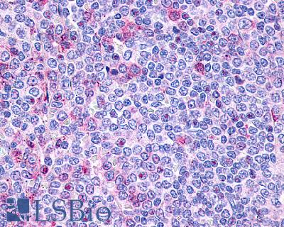 Anti-P2RY10 / P2Y10 antibody LS-A860 IHC of human spleen, lymphocytes. Immunohistochemistry of formalin-fixed, paraffin-embedded tissue after heat-induced antigen retrieval.