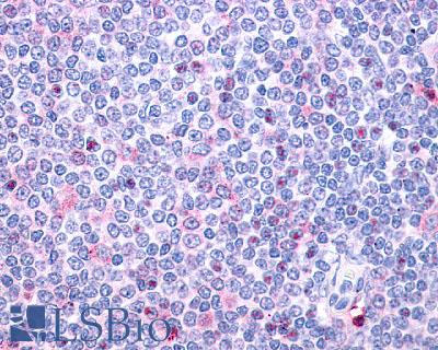Anti-P2RY10 / P2Y10 antibody LS-A862 IHC of human spleen, lymphocytes. Immunohistochemistry of formalin-fixed, paraffin-embedded tissue after heat-induced antigen retrieval.