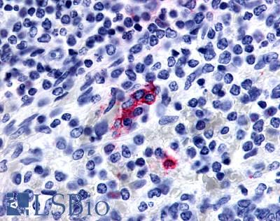 Anti-P2RY13 / P2Y13 antibody LS-A4853 IHC of human spleen. Immunohistochemistry of formalin-fixed, paraffin-embedded tissue after heat-induced antigen retrieval.