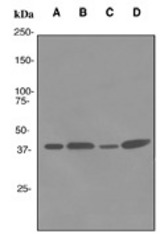 Western blot analysis on (A) human spleen, (B) HeLa, (C) HepG2 and (D) Jurkat cell lysates using anti-GPR94 antibody.