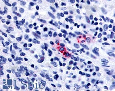 Anti-P2RY13 / P2Y13 antibody LS-A4905 IHC of human spleen. Immunohistochemistry of formalin-fixed, paraffin-embedded tissue after heat-induced antigen retrieval.