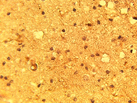 IHC of normal human brain tissue using P2Y13 antibody (LS-C140621) at 15 ug/ml