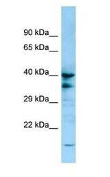 P2Y13 / P2RY13 antibody Western Blot of 721_B.