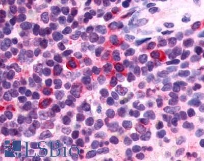 Anti-P2RY13 / P2Y13 antibody LS-A1622 IHC of human spleen. Immunohistochemistry of formalin-fixed, paraffin-embedded tissue after heat-induced antigen retrieval.