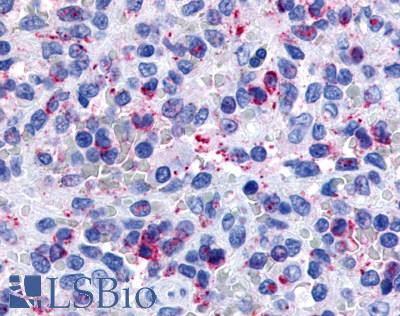 Anti-P2RY13 / P2Y13 antibody LS-A1620 IHC of human spleen. Immunohistochemistry of formalin-fixed, paraffin-embedded tissue after heat-induced antigen retrieval.
