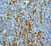 IHC of paraffin-embedded spleen tissue using anti-p40 antibody.