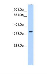 Fetal Thymus cell lysate. Antibody concentration: 0.25 ug/ml. Gel concentration: 12%.