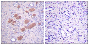 IHC of paraffin-embedded human ovary, using p40 phox (Phospho-Thr154) Antibody. The sample on the right was incubated with synthetic peptide.