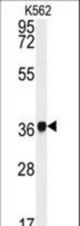 Western blot of NCF4 antibody in K562 cell line lysates (35 ug/lane). NCF4 (arrow) was detected using the purified antibody.