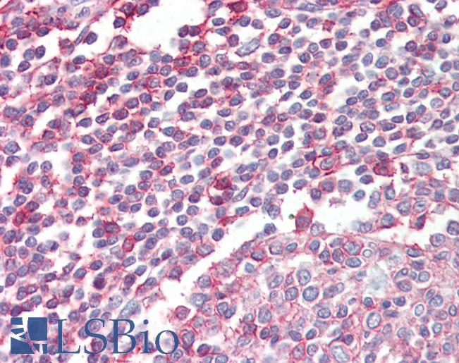 Anti-NCF4 antibody IHC of human tonsil. Immunohistochemistry of formalin-fixed, paraffin-embedded tissue after heat-induced antigen retrieval. Antibody LS-B3604 concentration 2.5 ug/ml.