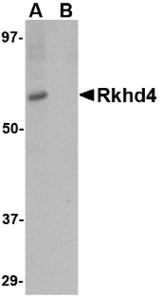 Western blot of Rkhd4 in SK-N-SH cell lysate with Rkhd4 antibody at 1 ug/ml in (A) the absence and (B) the presence of blocking peptide