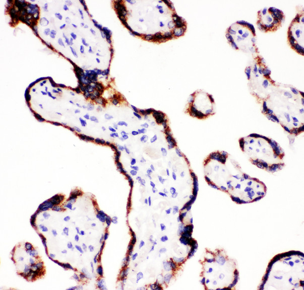 P450SCC / CYP11A1 antibody. IHC(P): Human Placenta Tissue.