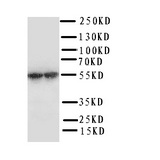WB of P450SCC / CYP11A1 antibody. WB: Human Placenta Tissue Lysate.
