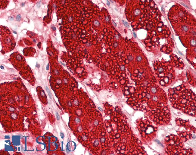 Human Adrenal: Formalin-Fixed, Paraffin-Embedded (FFPE)