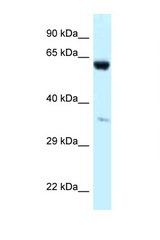 P4HA1 antibody LS-C145718 Western blot of 293T Cell lysate. Antibody concentration 1 ug/ml.