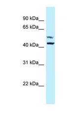 P4HA1 antibody LS-C145880 Western blot of 3 Cell lysate. Antibody concentration 1 ug/ml.