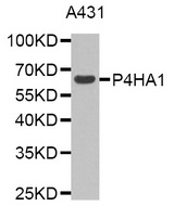 Western blot analysis of extracts of A431 cell line, using P4HA1 antibody.
