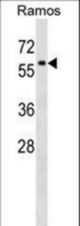 P4HA1 Antibody western blot of Ramos cell line lysates (35 ug/lane). The P4HA1 antibody detected the P4HA1 protein (arrow).