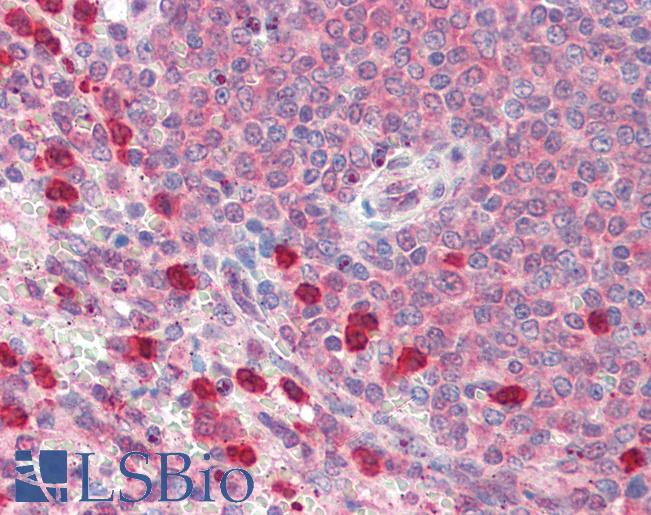 Anti-P4HA1 antibody IHC of human spleen. Immunohistochemistry of formalin-fixed, paraffin-embedded tissue after heat-induced antigen retrieval. Antibody LS-B3291 concentration 5 ug/ml.