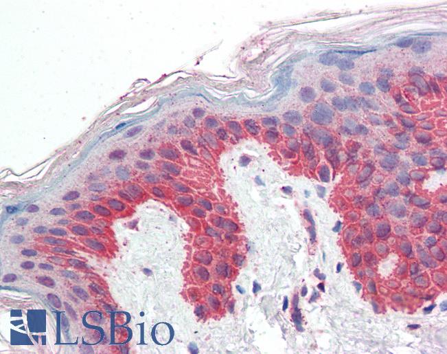 Anti-P4HA1 antibody IHC of human skin. Immunohistochemistry of formalin-fixed, paraffin-embedded tissue after heat-induced antigen retrieval. Antibody LS-B3291 concentration 5 ug/ml.