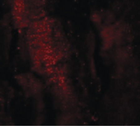 Immunofluorescence of RKHD3 in mouse skeletal muscle cells with RKHD3 antibody at 20 ug/ml.