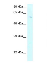 P4HA2 antibody LS-C145735 Western blot of HepG2 Cell lysate. Antibody concentration 1 ug/ml.