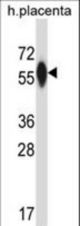 P4HA3 Antibody western blot of human placenta tissue lysates (35 ug/lane). The P4HA3 antibody detected the P4HA3 protein (arrow).