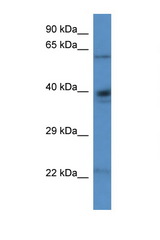 ALDH4A1 antibody LS-C135183 Western blot of Rat Kidney lysate. Antibody concentration 1 ug/ml.