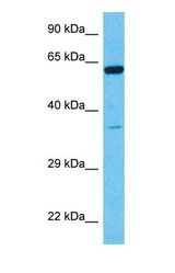 Western blot of ALDH4A1 Antibody with human Fetal Liver lysate.