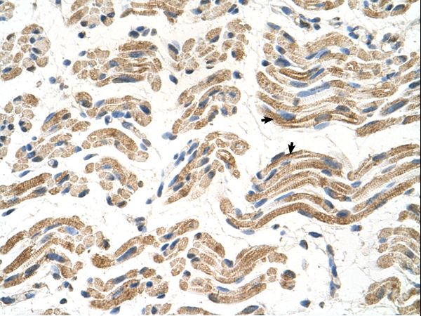 ALDH4A1 antibody LS-C80756 was used in IHC to stain formalin-fixed, paraffin-embedded human muscle.