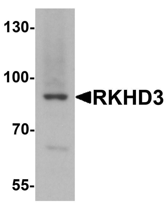 Western blot analysis of RKHD3 in mouse skeletal muscle tissue lysate with RKHD3 antibody at 1 ug/ml.
