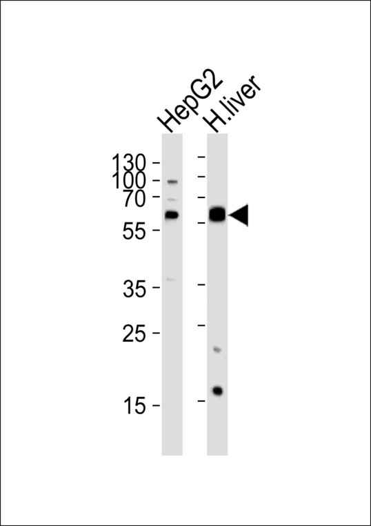 Western blot of lysates from HepG2 cell line and human liver tissue lysate (from left to right) with ALDH4A1 Antibody. Antibody was diluted at 1:1000 at each lane. A goat anti-rabbit IgG H&L (HRP) at 1:5000 dilution was used as the secondary antibody. Lysates at 35 ug per lane.