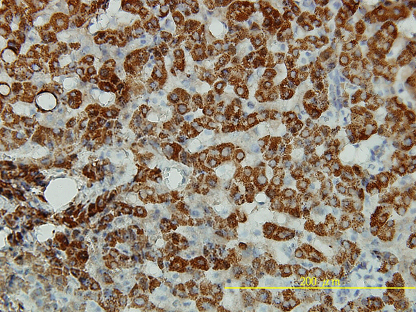 Immunoperoxidase of monoclonal antibody to ALDH4A1 on formalin-fixed paraffin-embedded human liver tissue.[antibody concentration 5 ug/ml].