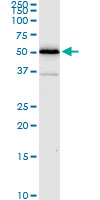 ALDH4A1 monoclonal antibody (M01), clone 1A12-A5. Western blot of ALDH4A1 expression in A-431.