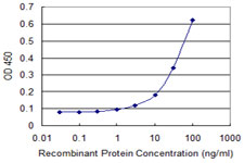 Detection limit for recombinant GST tagged ALDH4A1 is approximately 0.1 ng/ml as a capture antibody.