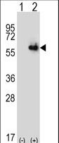 Western blot of ALDH4A1 (arrow) using rabbit polyclonal ALDH4A1 Antibody. 293 cell lysates (2 ug/lane) either nontransfected (Lane 1) or transiently transfected (Lane 2) with the ALDH4A1 gene.