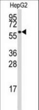 Western blot of anti-ALDH4A1 Antibody in HepG2 cell line lysates (35 ug/lane). ALDH4A1(arrow) was detected using the purified antibody.